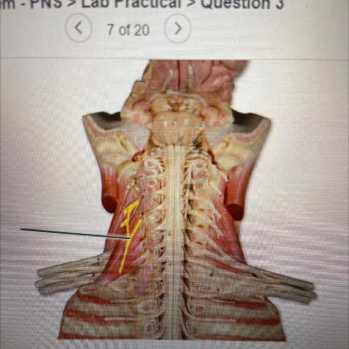 Identify the highlighted structure bone