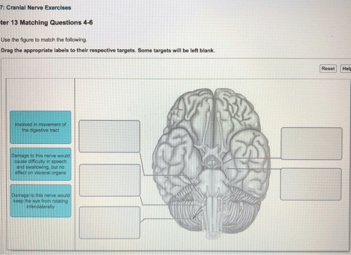 Chapter 13 matching questions 4-6