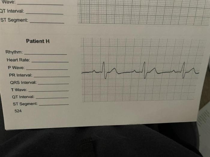 Part b practice interpreting electrocardiograms answer key