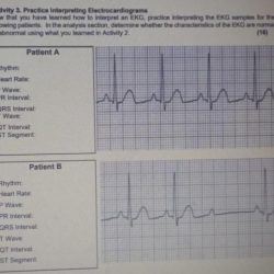 Part b practice interpreting electrocardiograms answer key