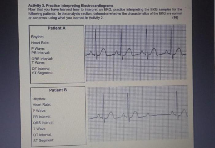 Part b practice interpreting electrocardiograms answer key