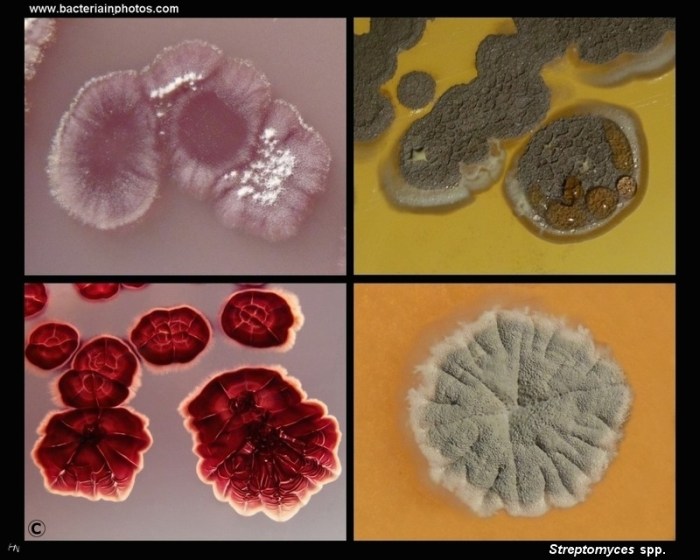 Streptomyces differs from actinomyces because streptomyces