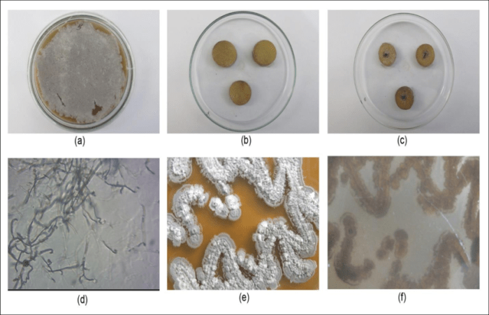 Streptomyces plate aia species colonies soil